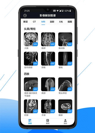 影像解剖图谱截图