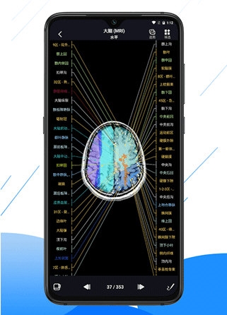 影像解剖图谱截图