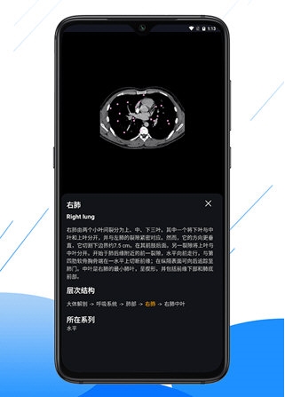 影像解剖图谱截图